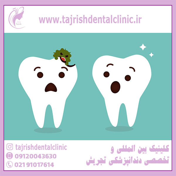 داروهای پیشگیری از پوسیدگی دندان