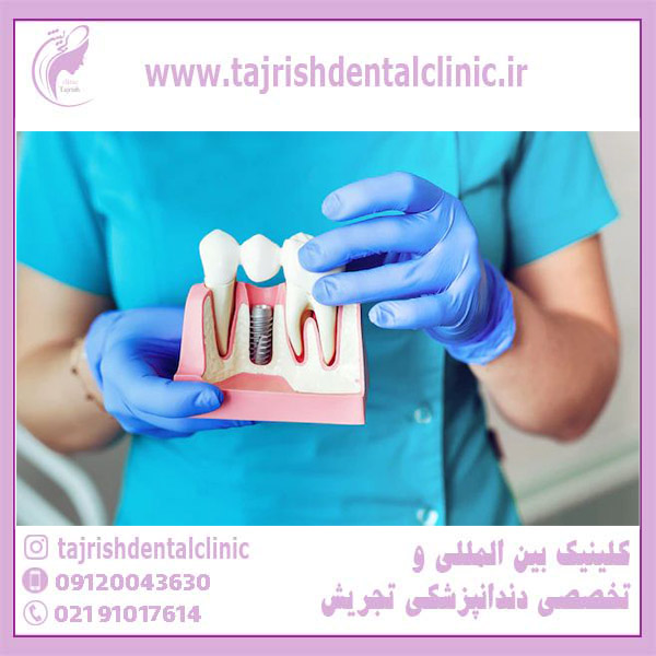 بهترین کلینیک دندان پزشکی شیراز ارتودنسی