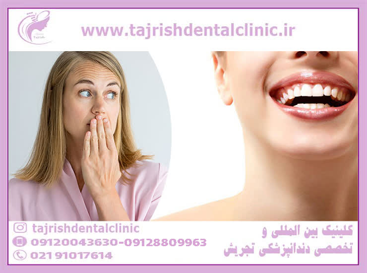 دندان - کلینیک دندان پزشکی تجریش 